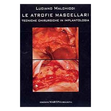Le atrofie mascellari - Tecniche chirurgiche in implantologia