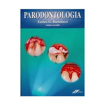 Parodontologia. Testo Atlante  2voll.