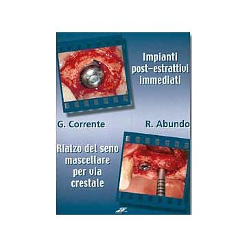 Impianti post-estrattivi immediati. Rialzo del seno mascellare per via crestale