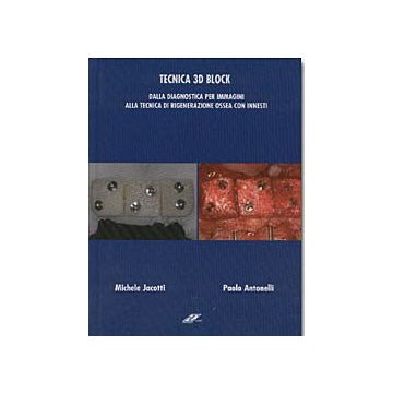 TECNICA 3D BLOCK Dalla diagnostica per immagini alla tecnica di rigenerazione ossea con innesti