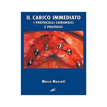 Il carico immediato in implantologia. Protocolli operativi  + DVD