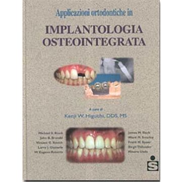 Applicazioni Ortodontiche in Implantologia Osteointegrata