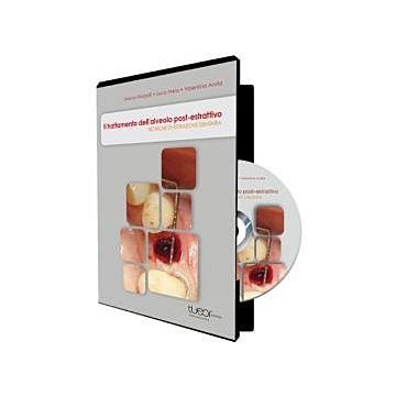 Il trattamento dell'alveolo post-estrattivo. Tecniche di estrazione dentaria DVD