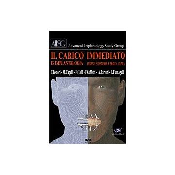 Il Carico Immediato in Implantologia - DVD